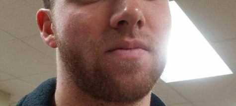Do Not Conform to the Hairiness